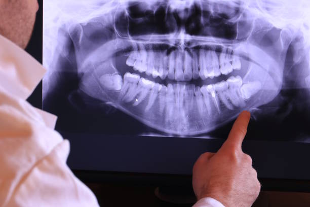 Best Cracked Tooth Emergency Dentist  in Manhasset, NY